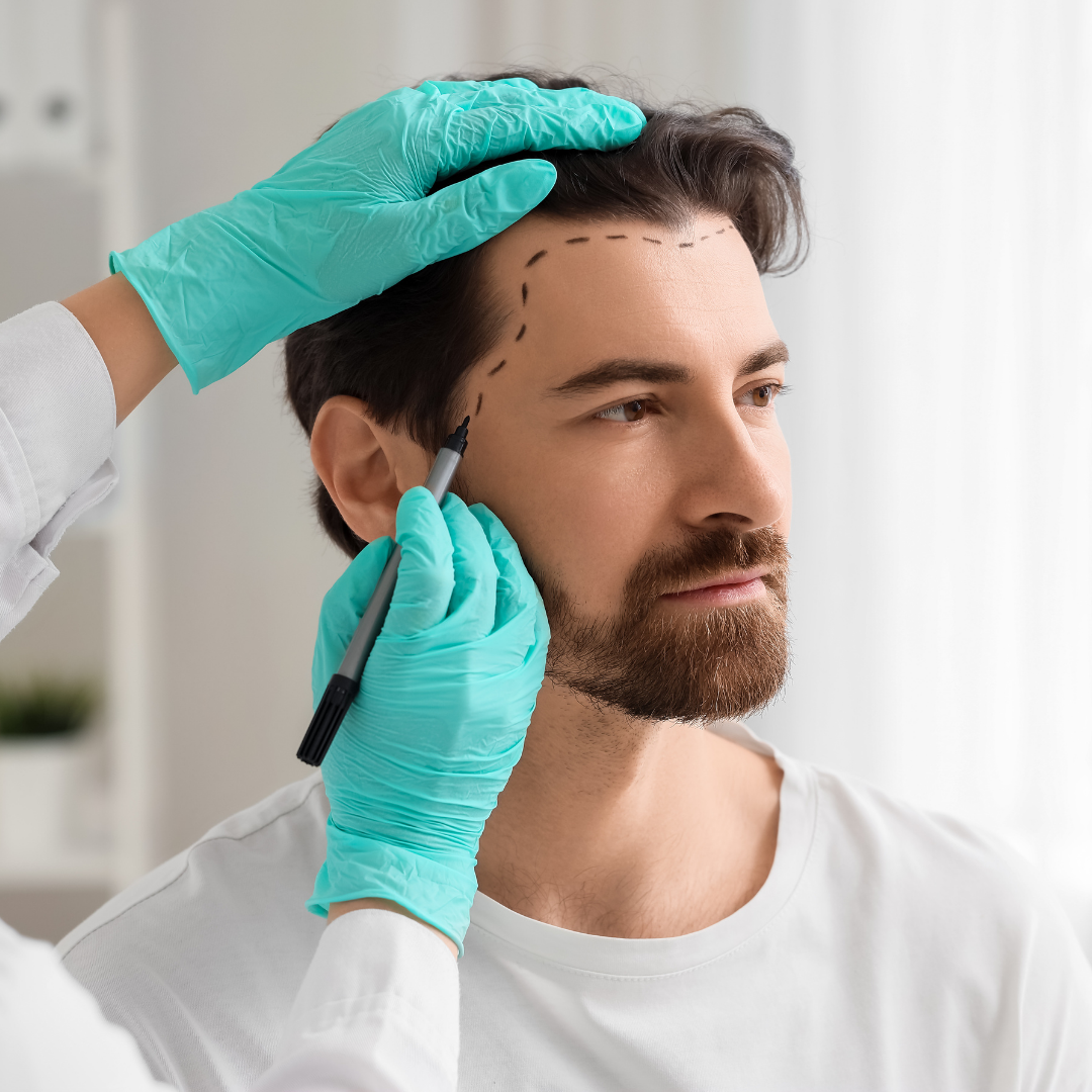 Hair Transplant